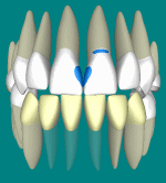 Animated 3D jaw and teeth