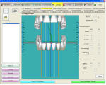 tmj chart small